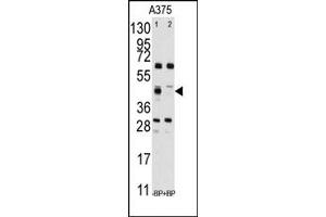 Image no. 1 for anti-Farnesyl-Diphosphate Farnesyltransferase 1 (FDFT1) (Middle Region) antibody (ABIN357712) (FDFT1 anticorps  (Middle Region))