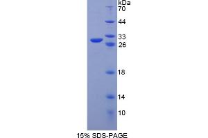 Image no. 1 for POU Class 5 Homeobox 1 (POU5F1) (AA 129-352) protein (His tag) (ABIN4988420) (OCT4 Protein (AA 129-352) (His tag))