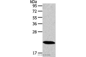 Western blot analysis of Mouse heart tissue, using RAB18 Polyclonal Antibody at dilution of 1:400 (RAB18 anticorps)