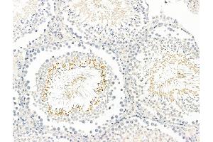 ABIN7093129 and ABIN7098933 at 1/100 staining Rat testis tissue by IHC-P. (BAGE2 anticorps  (Internal Region))
