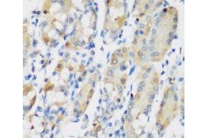 Immunohistochemistry of paraffin-embedded Human stomach using RRM1 Polyclonal Antibody at dilution of 1:200 (40x lens).