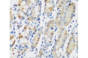 Immunohistochemistry of paraffin-embedded Human stomach using RRM1 Polyclonal Antibody at dilution of 1:200 (40x lens). (RRM1 anticorps)