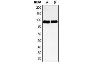 Western blot analysis of Nibrin expression in HeLa (A), HL60 (B) whole cell lysates. (Nibrin anticorps  (Center))
