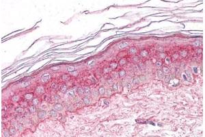 Human Skin: Formalin-Fixed, Paraffin-Embedded (FFPE) (GM2A anticorps  (C-Term))