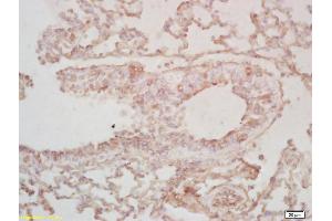 Formalin-fixed and paraffin embedded mouse lung labeled with Rabbit Anti BCAS2 Polyclonal Antibody, Unconjugated (ABIN718811) at 1:200 followed by conjugation to the secondary antibody and DAB staining