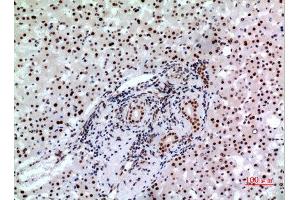 Immunohistochemistry (IHC) analysis of paraffin-embedded Human Liver, antibody was diluted at 1:100.