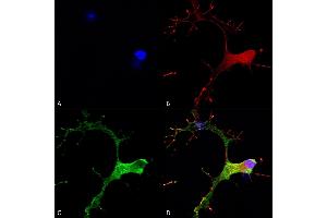 Immunocytochemistry/Immunofluorescence analysis using Mouse Anti-GABA-B Receptor 1 Monoclonal Antibody, Clone S93A-49 (ABIN2484102).