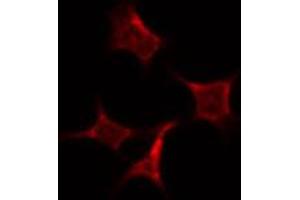 ABIN6274040 staining HepG2 by IF/ICC. (PRC1 anticorps  (Internal Region))