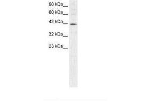 Image no. 1 for anti-Mesoderm Induction Early Response 1 (MIER1) (AA 250-293) antibody (ABIN202515) (MIER1 anticorps  (AA 250-293))