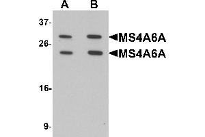 Western blot analysis of MS4A6A in 293 cell lysate with MS4A6A antibody at (A) 1 and (B) 2 µg/mL. (MS4A6A anticorps  (N-Term))