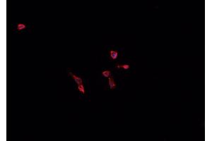 ABIN6268860 staining U-937 cells by IF/ICC.