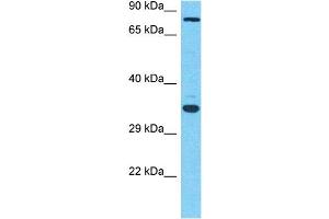 Host:  Rabbit  Target Name:  MGAT5  Sample Type:  OVCAR-3 Whole Cell lysates  Antibody Dilution:  1. (MGAT5 anticorps  (C-Term))