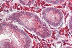 anti-B-Cell CLL/lymphoma 3 (BCL3) (AA 2-13) antibody