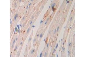 IHC-P analysis of Kidney tissue, with DAB staining. (ADCY9 anticorps  (AA 852-1065))