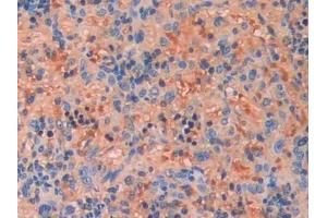DAB staining on IHC-P; Samples: Rat Spleen Tissue (FGF13 anticorps  (AA 1-192))