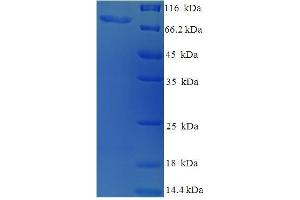 SDS-PAGE (SDS) image for SWI/SNF Related, Matrix Associated, Actin Dependent Regulator of Chromatin, Subfamily A, Member 2 (SMARCA2) (AA 700-1216), (partial) protein (His-SUMO Tag) (ABIN5710378)