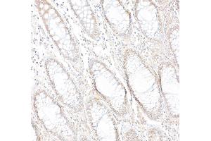 anti-Poly (ADP-Ribose) Polymerase Family, Member 10 (PARP10) (AA 300-350) antibody