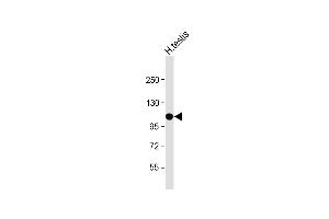 Anti-SLC14A2 Antibody (N-Term) at 1:500 dilution + Human testis lysate Lysates/proteins at 20 μg per lane. (Solute Carrier Family 14 (Urea Transporter, Kidney) Member 2 (SLC14A2) (AA 42-76) anticorps)