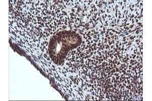 Image no. 8 for anti-Von Hippel-Lindau Tumor Suppressor, E3 Ubiquitin Protein Ligase (VHL) antibody (ABIN1501712)