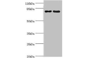 Western blot All lanes: MTRR antibody at 2 μg/mL Lane 1: PC-3 whole cell lysate Lane 2: HepG2 whole cell lysate Secondary Goat polyclonal to rabbit IgG at 1/10000 dilution Predicted band size: 81, 78, 7 kDa Observed band size: 81 kDa (MTRR anticorps  (AA 1-725))
