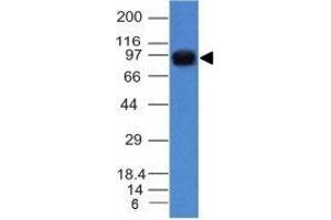 Image no. 4 for anti-Nucleolin (NCL) antibody (ABIN6166144)