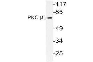 Western blot (WB) analysis of PKC beta antibody in extracts from HeLa cells (PKC beta anticorps)