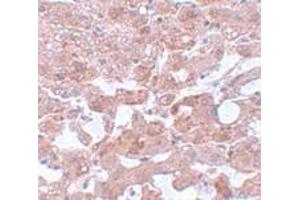 Immunohistochemistry (IHC) image for anti-Cell Division Cycle 16 Homolog (S. Cerevisiae) (CDC16) (N-Term) antibody (ABIN1031232) (CDC16 anticorps  (N-Term))