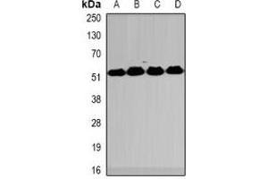 Western blot analysis of MeCP2 expression in HT29 (A), Jurkat (B), mouse spleen (C), mouse lung (D) whole cell lysates. (MECP2 anticorps)