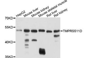 Western blot analysis of extracts of various cells, using TMPRSS11D antibody. (TMPRSS11D anticorps)