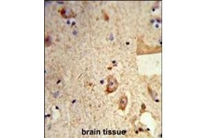 Formalin-fixed and paraffin-embedded human brain tissue reacted with DSTN Antibody (Center), which was peroxidase-conjugated to the secondary antibody, followed by DAB staining.