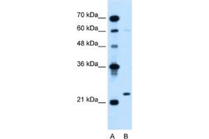 Western Blotting (WB) image for anti-Immunoglobulin lambda-Like Polypeptide 1 (IGLL1) antibody (ABIN2462601) (IGLL1 anticorps)
