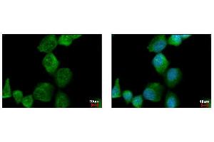 ICC/IF Image PAK1 antibody detects PAK1 protein at cytoplasm by immunofluorescent analysis.