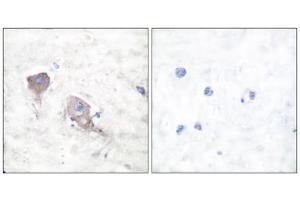 Immunohistochemical analysis of paraffin-embedded human brain tissue using SNAP25 antibody (ABIN5976506). (SNAP25 anticorps  (C-Term))