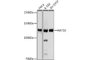 Western blot analysis of extracts of various cell lines, using N antibody (ABIN7268774) at 1:1000 dilution. (NAT10 anticorps)
