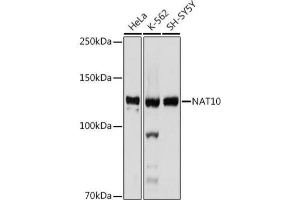 NAT10 anticorps