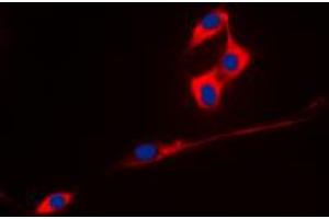 Immunofluorescent analysis of ECHOS1 staining in A431 cells. (TMPRSS3 anticorps  (C-Term))