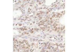 Immunohistochemistry (IHC) image for anti-General Transcription Factor IIIC, Polypeptide 5 (GTF3C5) (AA 469-519) antibody (ABIN7454732)