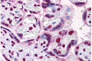 Human Placenta: Formalin-Fixed, Paraffin-Embedded (FFPE)