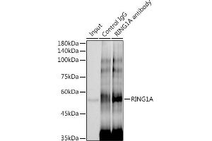 Immunoprecipitation analysis of 300 μg extracts of HeLa cells using 3 μg RING1A antibody (ABIN7270051). (RING1 anticorps)