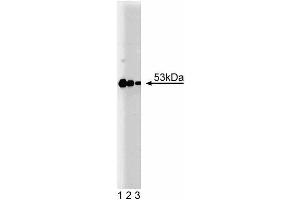 Western blot analysis of PKA RIIbeta on human endothelial lysate (left).