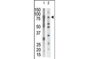 Antibody is used in Western blot to detect MMP15 in mouse brain tissue lysate (lane 1) and HL60 cell lysate (lane 2) lysate.
