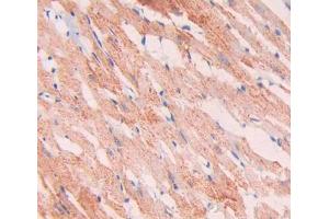 Used in DAB staining on fromalin fixed paraffin- embedded heart tissue (SNCAIP anticorps  (AA 766-963))