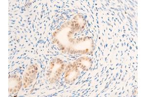 ABIN6267272 at 1/100 staining rat uterine tissue sections by IHC-P.