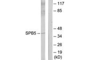 Western blot analysis of extracts from HeLa cells, using Serpin B5 Antibody. (SERPINB5 anticorps  (AA 91-140))
