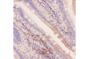 Anti-MRP4 Picoband antibody,  IHC(P): Mouse Intestine Tissue