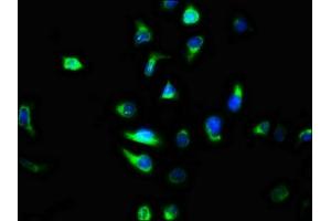 Immunofluorescence staining of A549 cells with ABIN7147330 at 1:100, counter-stained with DAPI. (TMEM2 anticorps  (AA 734-866))