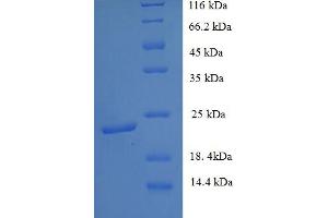 Ephrin B3 (EFNB3) (AA 28-227) protein (His tag)