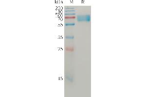 Human B Protein, His Tag on SDS-PAGE under reducing condition.