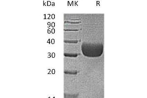 Western Blotting (WB) image for Coxsackie Virus and Adenovirus Receptor (CXADR) protein (His tag,AVI tag) (ABIN7320866)