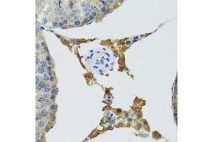 Immunohistochemistry of paraffin-embedded mouse testis using PLA2G2D antibody (ABIN5974036) at dilution of 1/100 (40x lens). (PLA2G2D anticorps)